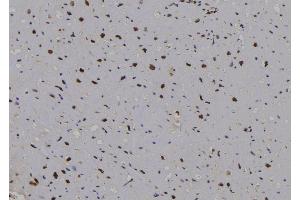 ABIN6276871 at 1/100 staining Human heart tissue by IHC-P. (Cyclin D2 抗体  (C-Term))