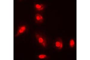 Immunofluorescent analysis of AKT (pY315) staining in A549 cells. (AKT1 抗体  (pTyr315))