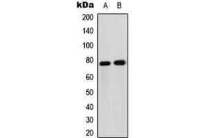 Western blot analysis of FOXO1 expression in Jurkat (A), HeLa (B) whole cell lysates. (FOXO1 抗体  (Center))