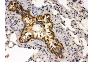 Anti- GRK5 Picoband antibody,IHC(P) IHC(P): Mouse Lung Tissue