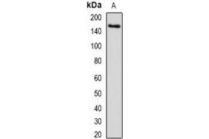 Western blot analysis of SETD5 expression in human liver (A) whole cell lysates. (SETD5 抗体)