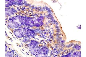 Immunohistochemistry (Paraffin-embedded Sections) (IHC (p)) image for anti-Protein Kinase, AMP-Activated, alpha 1 Catalytic Subunit (PRKAA1) (AA 351-450) antibody (ABIN2170161)