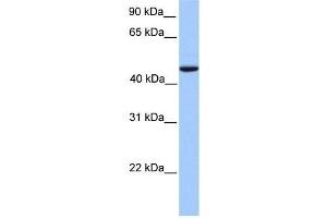 Human Lung; WB Suggested Anti-REXO4 Antibody Titration: 0. (REXO4 抗体  (Middle Region))