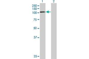 Western Blot analysis of DDX20 expression in transfected 293T cell line by DDX20 MaxPab polyclonal antibody. (DDX20 抗体  (AA 1-824))