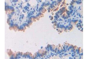 Immunohistochemistry (IHC) image for anti-Coagulation Factor V (F5) (AA 364-611) antibody (ABIN7438925)