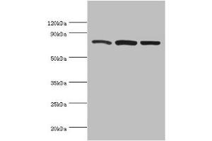 Western blot All lanes: Calpain-1 catalytic subunit antibody at 2 μg/mL Lane 1: A431 whole cell lysate Lane 2: Hela whole cell lysate Lane 3: Jurkat whole cell lysate Secondary Goat polyclonal to rabbit IgG at 1/10000 dilution Predicted band size: 82 kDa Observed band size: 82 kDa (CAPNL1 抗体  (Catalytic Subunit))