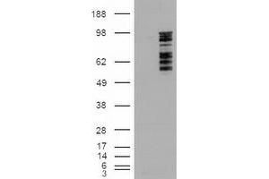 HEK293T cells were transfected with the pCMV6-ENTRY control (Left lane) or pCMV6-ENTRY MAPK6 (RC201597) (Right lane) cDNA for 48 hrs and lysed. (MAPK6 抗体  (AA 345-721))