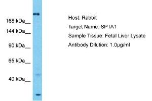 Host: Rabbit Target Name: SPTA1 Sample Tissue: Human Fetal Liver Antibody Dilution: 1ug/ml (SPTA1 抗体  (N-Term))