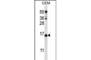 C Antibody (C-term) (ABIN656407 and ABIN2845701) western blot analysis in CEM cell line lysates (35 μg/lane). (CJ057 抗体  (C-Term))