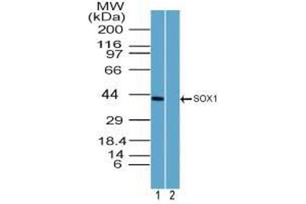 SOX1 抗体  (AA 100-150)