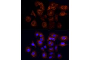 Immunofluorescence analysis of A-549 cells using CYFIP1 Rabbit mAb (ABIN7266665) at dilution of 1:50 (40x lens). (CYFIP1 抗体)