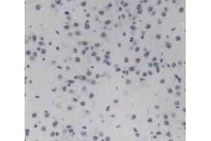 Used in DAB staining on fromalin fixed paraffin- embedded Kidney tissue (NUP214 抗体  (AA 601-868))
