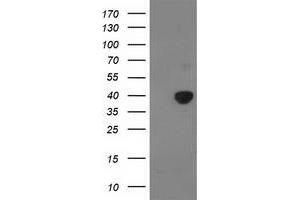 Image no. 1 for anti-Pyruvate Dehydrogenase (Lipoamide) alpha 1 (PDHA1) antibody (ABIN1500104) (PDHA1 抗体)