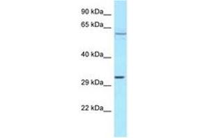 anti-Transforming Growth Factor beta Regulator 4 (TBRG4) (AA 323-372) antibody