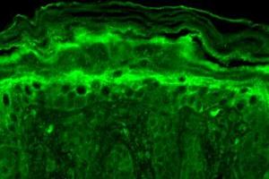 Immunohistochemistry (IHC) image for anti-Potassium Channel, Subfamily T, Member 1 (KCNT1) (AA 1168-1237) antibody (APC) (ABIN2482926)