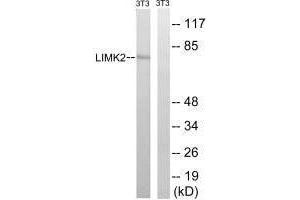 Western blot analysis of extracts from 3T3 cells, treated with PMA (125 ng/mL, 30 mins), using LIMK2 (Ab-283) antibody. (LIMK2 抗体  (Ser283))