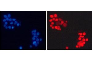 Immunofluorescence analysis of 293T cells using Asymmetric DiMethyl-Histone H3-R17 Polyclonal Antibody