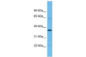 Western Blotting (WB) image for anti-Olfactory Receptor, Family 5, Subfamily H, Member 15 (OR5H15) (C-Term) antibody (ABIN2791757) (OR5H15 抗体  (C-Term))
