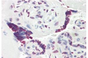 Formalin-Fixed, Paraffin-Embedded Human Placenta tissue stained with MCM3AP  Antibody  at 5 μg/ml after heat-induced antigen retrieval. (GANP 抗体  (C-Term))