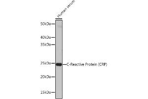Western blot analysis of extracts of Human serum, using C-Reactive Protein (C-Reactive Protein (CRP)) antibody (ABIN7265972) at 1:1000 dilution.