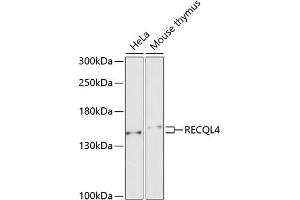 Western blot analysis of extracts of various cell lines, using RECQL4 antibody (ABIN6130663, ABIN6146846, ABIN6146847 and ABIN6222575) at 1:1000 dilution. (RECQL4 抗体  (AA 231-330))