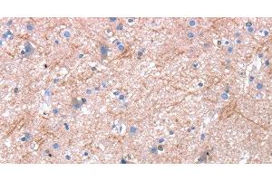 Immunohistochemistry of paraffin-embedded Human brain using Dap3 Polyclonal Antibody at dilution of 1:45 (DAP3 抗体)