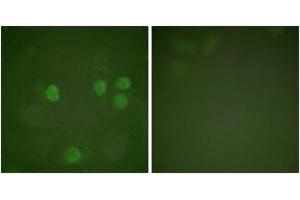 Immunofluorescence (IF) image for anti-Cyclin B1 (CCNB1) (AA 91-140) antibody (ABIN2888597) (Cyclin B1 抗体  (AA 91-140))