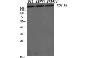 Western Blotting (WB) image for anti-Collagen, Type I, alpha 2 (COL1A2) (N-Term) antibody (ABIN3174478) (COL1A2 抗体  (N-Term))