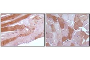 Immunohistochemistry (IHC) image for anti-Myoglobin (MB) antibody (ABIN1108360) (Myoglobin 抗体)