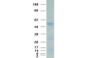 Western Blotting (WB) image for Ets Variant 6 (ETV6) protein (Myc-DYKDDDDK Tag) (ABIN2720586)