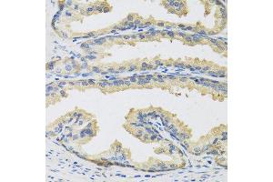 Immunohistochemistry of paraffin-embedded human prostate using CST3 antibody at dilution of 1:100 (40x lens). (CST3 抗体)