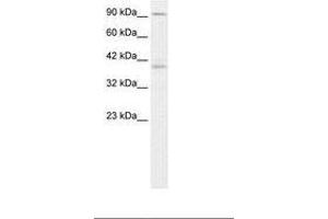 Image no. 2 for anti-Kinesin Family Member C2 (KIFC2) (AA 150-199) antibody (ABIN202931) (KIFC2 抗体  (AA 150-199))