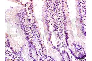 Formalin-fixed and paraffin embedded rat small intestine labeled with Anti-Egr1 Polyclonal Antibody, Unconjugated (ABIN737301) at 1:200 followed by conjugation to the secondary antibody and DAB staining. (EGR1 抗体  (AA 401-453))