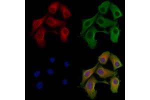 ABIN6257100 and ABIN6275625 staining Hela cells by IF/ICC. (CCT8 抗体  (Internal Region))