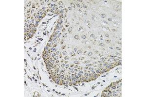 Immunohistochemistry of paraffin-embedded human esophagus using SDC2 antibody at dilution of 1:100 (x40 lens). (Syndecan 2 抗体)