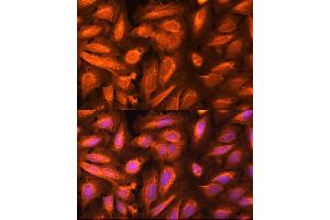 Immunofluorescence analysis of U-2 OS cells using DTYMK Rabbit pAb (ABIN6133500, ABIN6139855, ABIN6139856 and ABIN6221989) at dilution of 1:100 (40x lens). (DTYMK 抗体  (AA 1-212))