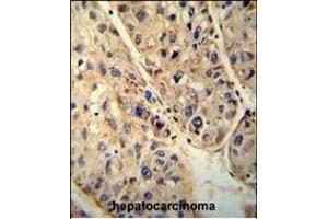 Immunohistochemistry (Paraffin-embedded Sections) (IHC (p)) image for anti-ATP-Binding Cassette, Sub-Family D (Ald), Member 1 (ABCD1) (AA 257-285) antibody (ABIN654412)