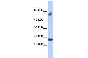 WB Suggested Anti-FLJ35767 Antibody Titration: 0. (FLJ35767 (Middle Region) 抗体)