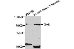 Western blot analysis of extract of SW480 and mouse skeletal muscle cells, using GAN antibody. (GAN 抗体)