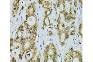 Immunohistochemistry (Paraffin-embedded Sections) (IHC (p)) image for anti-Ribosomal Protein S7 (RPS7) antibody (ABIN7262639)