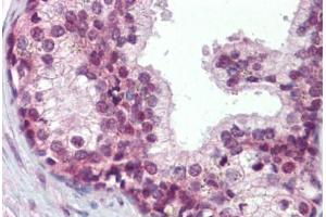 Human Prostate (formalin-fixed, paraffin-embedded) stained with ELF4 antibody ABIN462321 followed by biotinylated goat anti-rabbit IgG secondary antibody ABIN481713, alkaline phosphatase-streptavidin and chromogen. (Elf4 抗体  (AA 211-237))