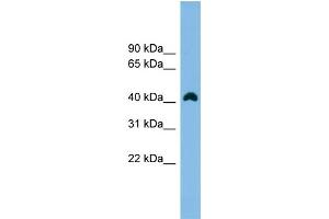 WB Suggested Anti-ANKRD42 Antibody Titration:  0. (ANKRD42 抗体  (N-Term))