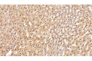 Immunohistochemistry (IHC) image for anti-Clusterin (CLU) (AA 228-449) antibody (ABIN7433222)