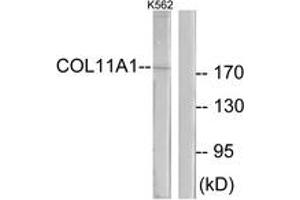 Western blot analysis of extracts from K562 cells, using Collagen XI alpha1 Antibody. (COL11A1 抗体  (AA 581-630))
