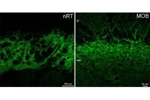 Immunohistochemistry (IHC) image for anti-gamma-aminobutyric Acid (GABA) A Receptor, alpha 3 (GABRA3) (AA 29-43) antibody (ABIN1742459)