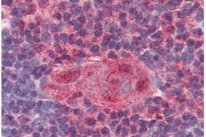 Human Thymus (formalin-fixed, paraffin-embedded) stained with UNG antibody ABIN364332 at 10 ug/ml followed by biotinylated anti-mouse IgG secondary antibody ABIN481714, alkaline phosphatase-streptavidin and chromogen.