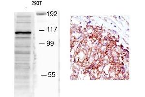Image no. 1 for anti-Mindbomb E3 Ubiquitin Protein Ligase 1 (MIB1) (N-Term) antibody (ABIN357602) (MIB1 抗体  (N-Term))