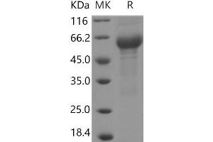Western Blotting (WB) image for Interleukin 6 Receptor, alpha (IL6RA) (Active) protein (His tag,ECD) (ABIN7321060) (IL6RA Protein (His tag,ECD))