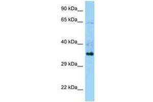 Image no. 1 for anti-Tripartite Motif Containing 44 (TRIM44) (C-Term) antibody (ABIN6748290) (TRIM44 抗体  (C-Term))