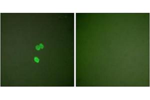 Immunofluorescence analysis of NIH/3T3 cells, using Galectin 3 antibody (ABIN5976406). (Galectin 3 抗体  (Internal Region))